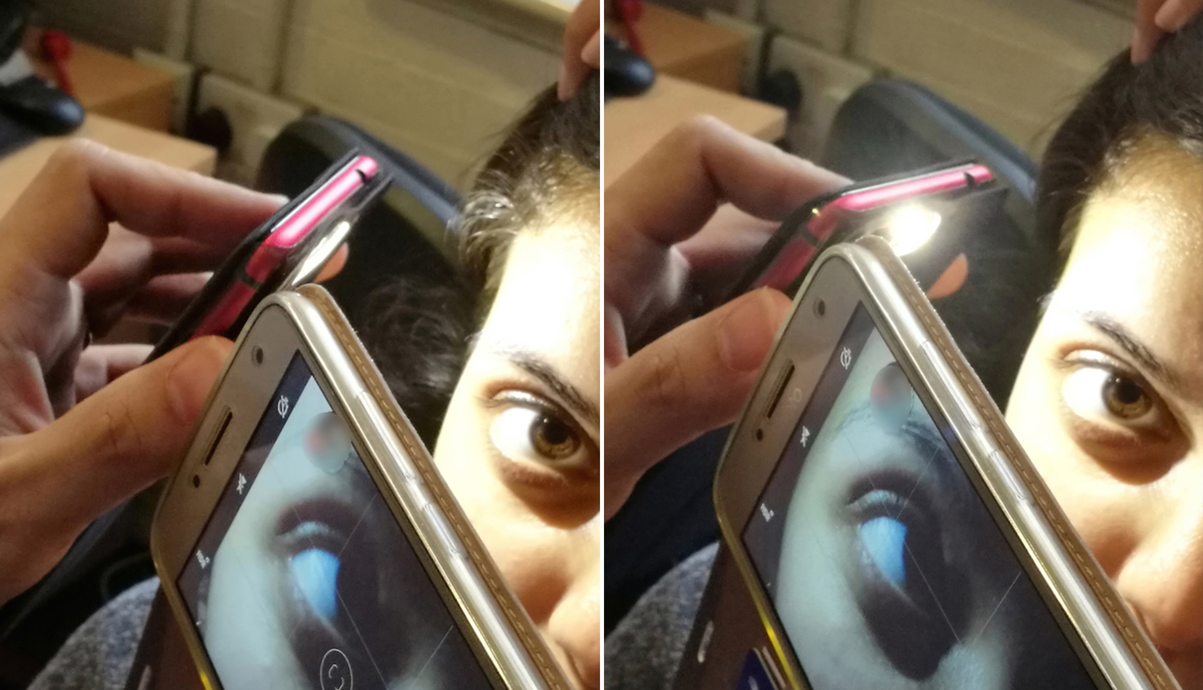 Use of two mobile phones to visualize corneal cystine crystals. A, Smartphone 1 (left) is used as the light source and smartphone 2 (right) captures a close-up image. B, Smartphone 1 is swiveled 30°-45° to obtain the specular reflection effect