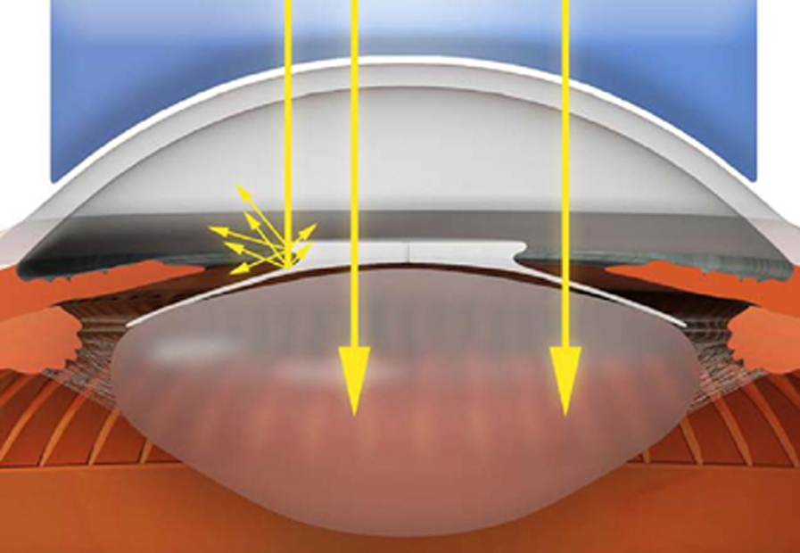 Optical blockage of the femtosecond laser beam by lens optic margin