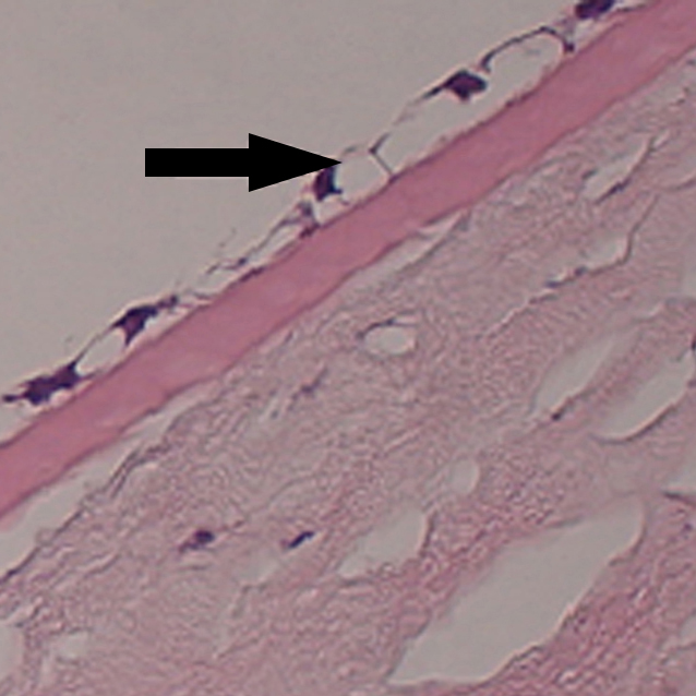 Light microscopy of corneal tissue (hematoxilin-eosin, original magnification ×40): travoprost-treated right eye