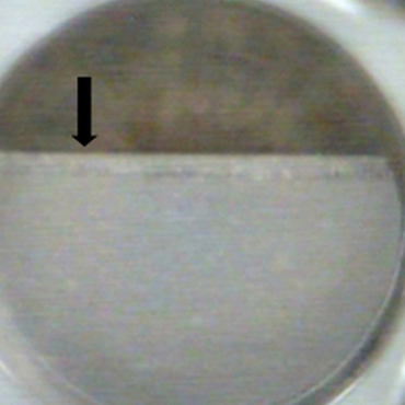 Photograph taken at moment of suction loss ; arrow indicates the location of the raster ablation at moment of loss of suction.