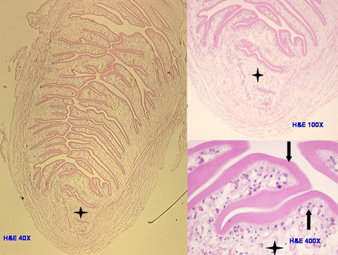 Photomicrograph depicts the only protoscolex of the cysticercus (left), which fell out of the loose stroma of the cyst during dissection. At higher magnifications (right) the protoscolex shows the same three layers of the rest of the cysticercus' loose stroma (4-point star), tegumental cells (up arrow), and wavy tegument (down arrow); however, the much thicker tegument is invaginated and stacked within the protoscolex.