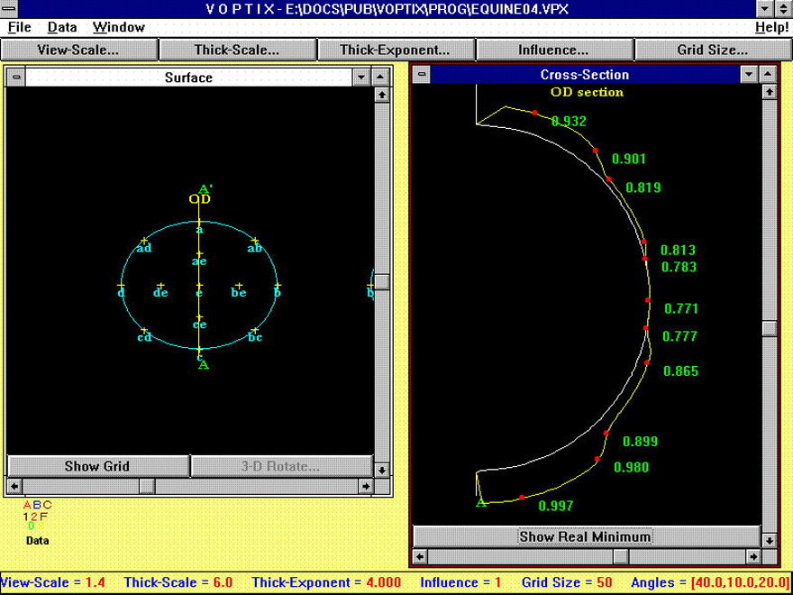 VOPTIX, a computer program for graphical display of corneal thickness data.